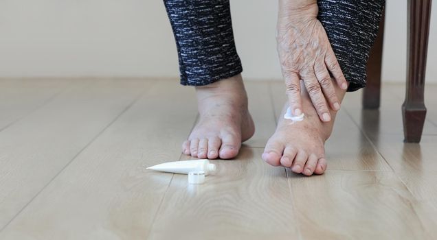 Elderly woman putting cream on swollen feet