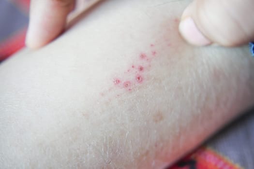 man suffering from itching skin, close up.