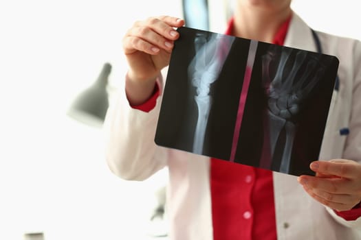 Orthopedist examines x-ray of patient hand in clinic