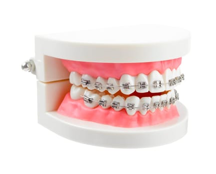 The Teeth model with metal wire dental braces or dental instruments isolated on white background, Save clipping path.