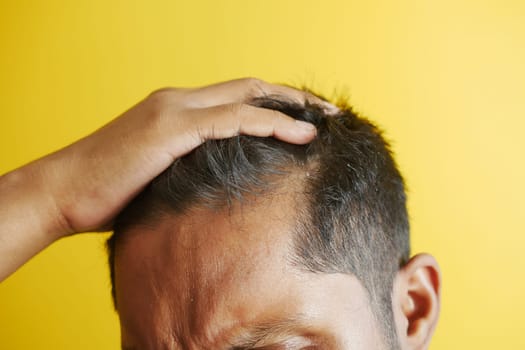 hair loss concept with man checking his hair