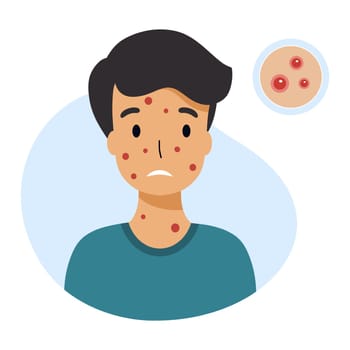 Boy with chickenpox symptoms. Skin rashes and pimples. Vector character in flat style.