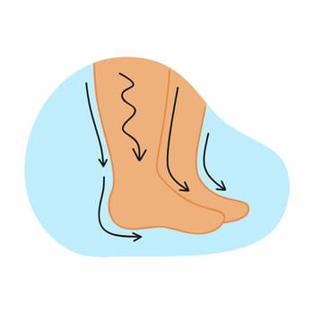 Human feet and leg swelling. Vector illustration on the topic of medicine.