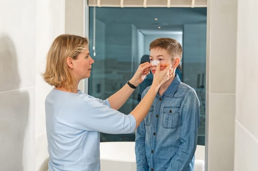 mom glues a patch to remove blackheads to her son. acne remover patch