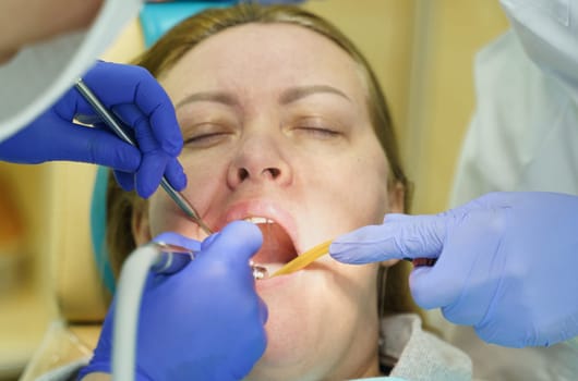 The dentist treats the teeth of the patient in the clinic.