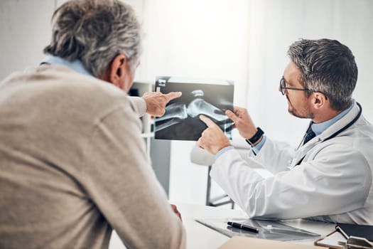 Is that thing supposed to be loose. a doctor and his mature patient looking at an x-ray together during a consultation.
