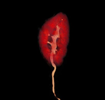 CTA Renal artery showing kidney 3D rendering image.