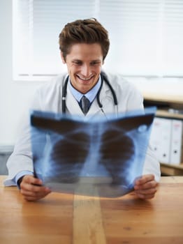 The results are clear. a positive-looking young doctor examining a chest x-ray.