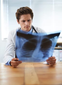 I cant see any problem...a concerned-looking young doctor examining a chest x-ray.