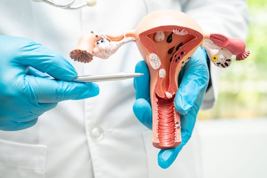 Uterus, doctor holding anatomy model for study diagnosis and treatment in hospital.