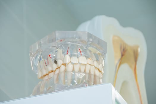Clean teeth denture, dental cut of the tooth, tooth model, and dentistry instruments in dentist's office.