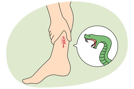 Snake bite person leg