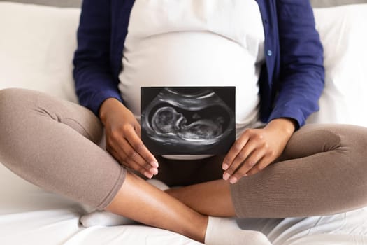 Millennial black woman in domestic clothes with big belly shows ultrasound picture, enjoys pregnancy