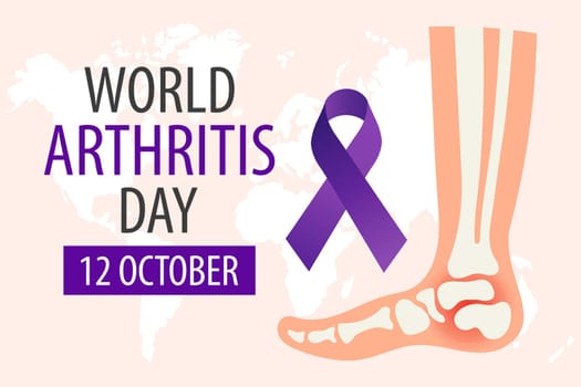 Rheumatoid Arthritis Awareness Day banner. Purple ribbon and foot joint. Medical concept. Poster, banner