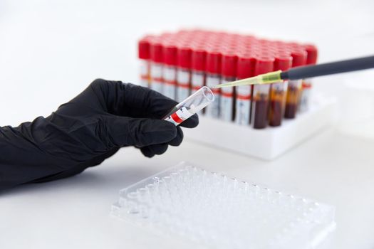 Blood test concept. hands of a lab technician with tube of blood sample and rack with other samples. holding blood tube sample for study