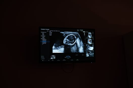 Screen shot of a second trimester prenatal screening.