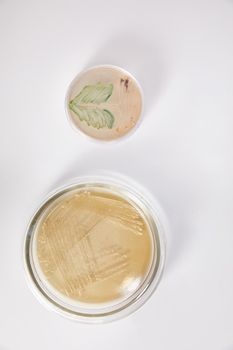 Microbiology Laboratory. Petri Dishes with Various Bacteria Samples