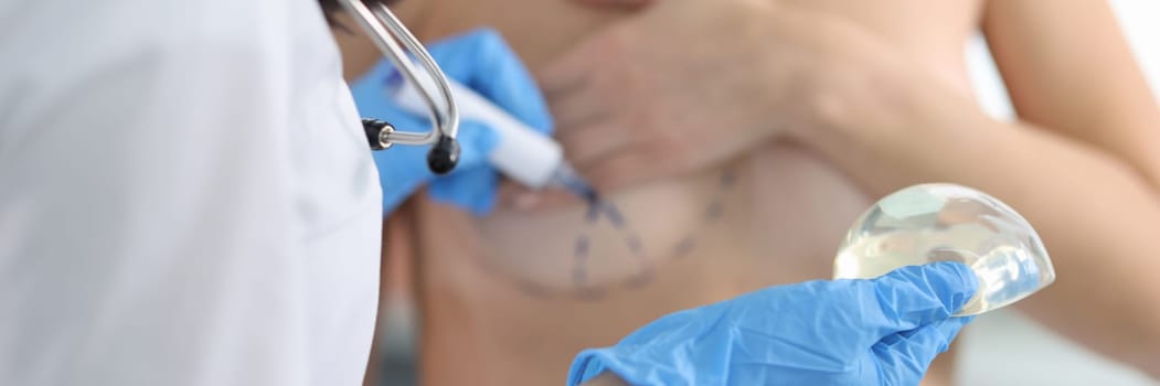 Doctor draws marks on female breast cosmetic surgery operation
