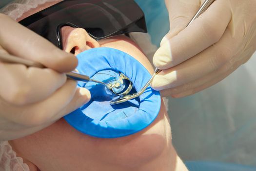 Young woman getting dental treatment at dentist office with a dental rubber dam protection