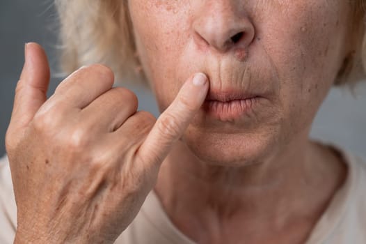 Unhappy elderly woman pointing at wrinkles around her lips.