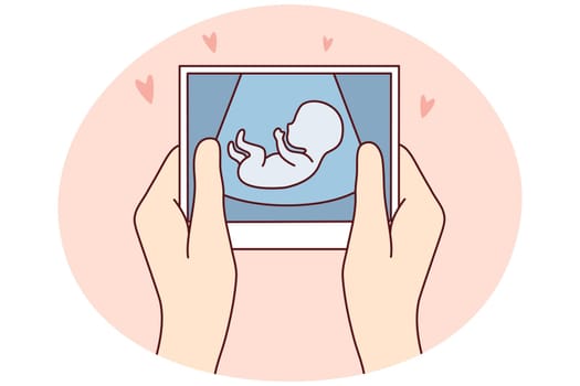 Future mother hold scan of embryo