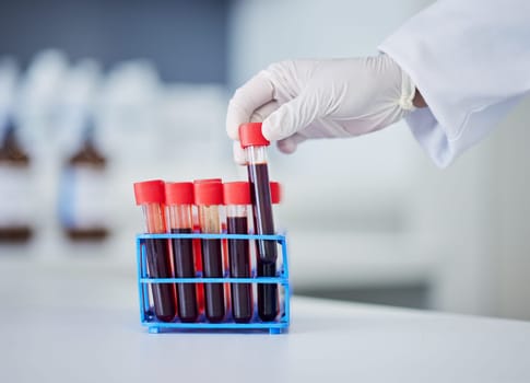 Hand, doctor and blood in test tube, health and sample for experiment with medical research in lab. Scientist, person and healthcare, check for virus or bacteria with scientific study and pathology