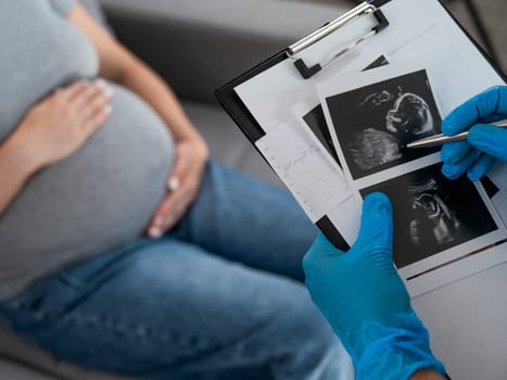Gynecologist looks at an ultrasound of a pregnant woman.