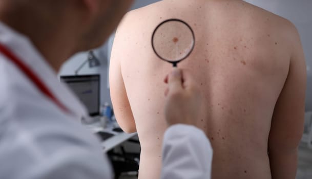 Male doctor look at magnifying glass on patient skin