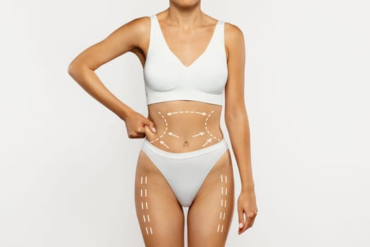 Millennial european woman in underwear touches fold of skin at waist with abstract lines for surgery