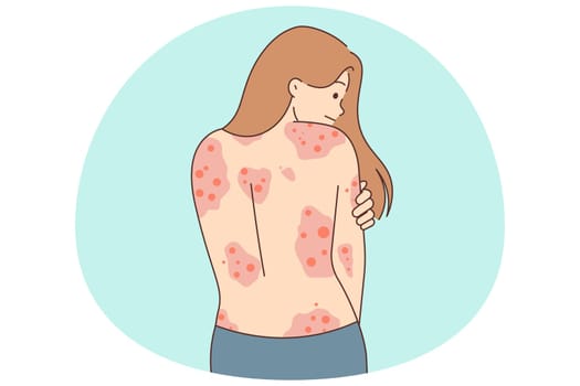 Unhealthy woman show red rash on back