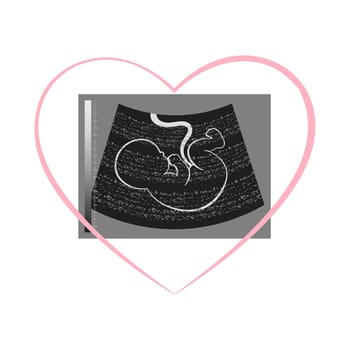 Photograph of an ultrasound of an unborn baby embryo in a heart. Illustration, postcard