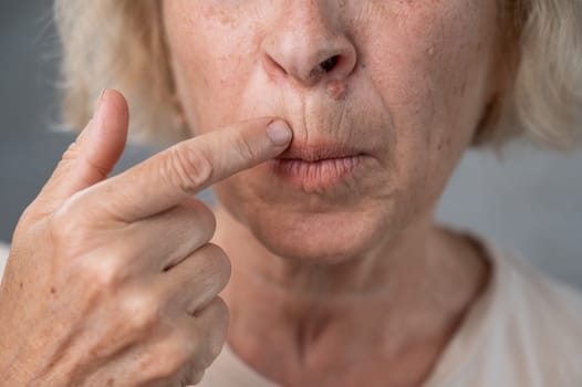 Unhappy elderly woman pointing at wrinkles around her lips.