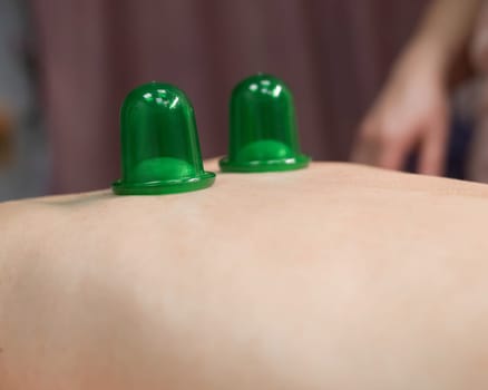 A woman undergoing a massage using vacuum plastic jars.