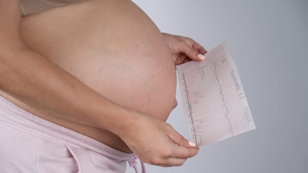 Pregnant woman with bare belly holding Cardiotocography results.
