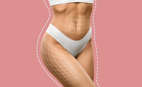 Conceptual Body Contouring and Shapewear, Cropped of Woman in Underwear