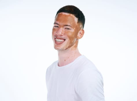 Happy, handsome and portrait of man with vitiligo or skin pigmentation on a white studio background. Face of unique and confident male person or albino with smile for melanin condition or mixed tone