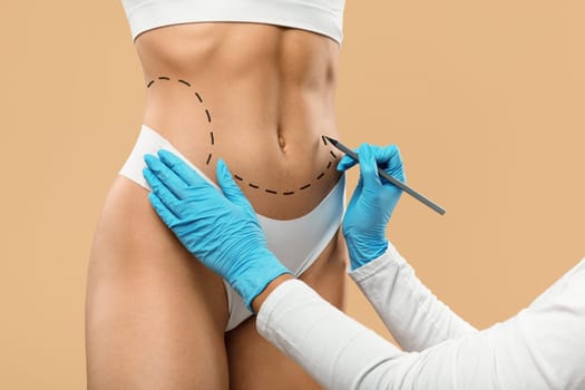 Doctor Drawing Dashed Line Marks On Female Body Before Plastic Surgery Operation