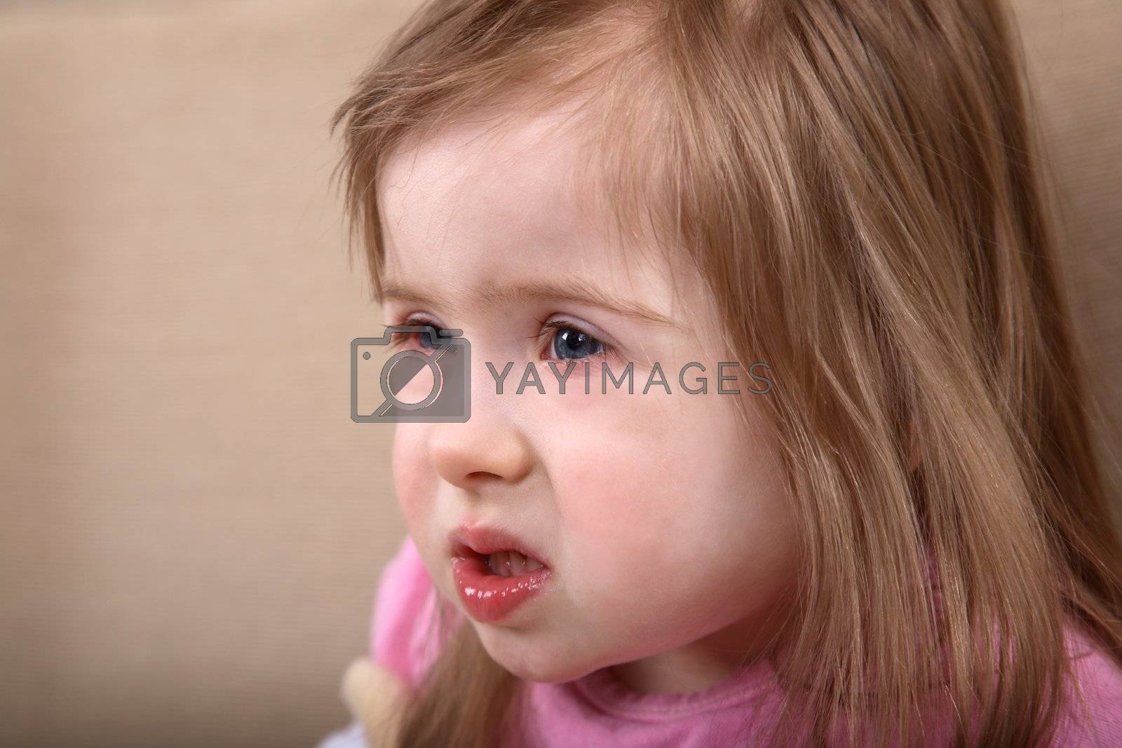 Royalty free image of Down syndrome girl by linea