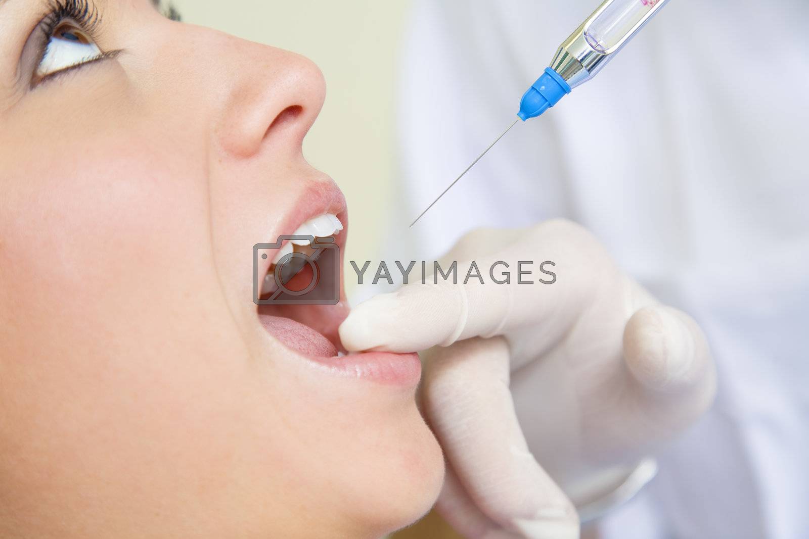 dentist holding a syringe and anesthetizing his patient. Close-up of mouth open