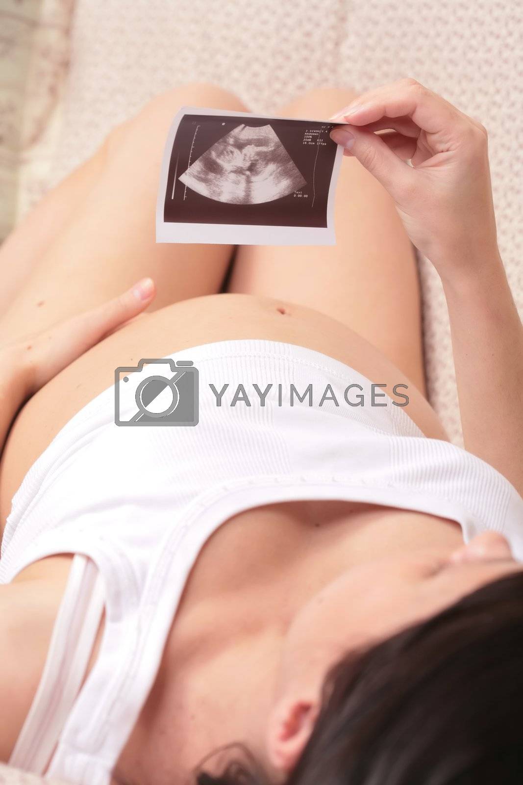 Royalty free image of admiration ultrasound by Astroid