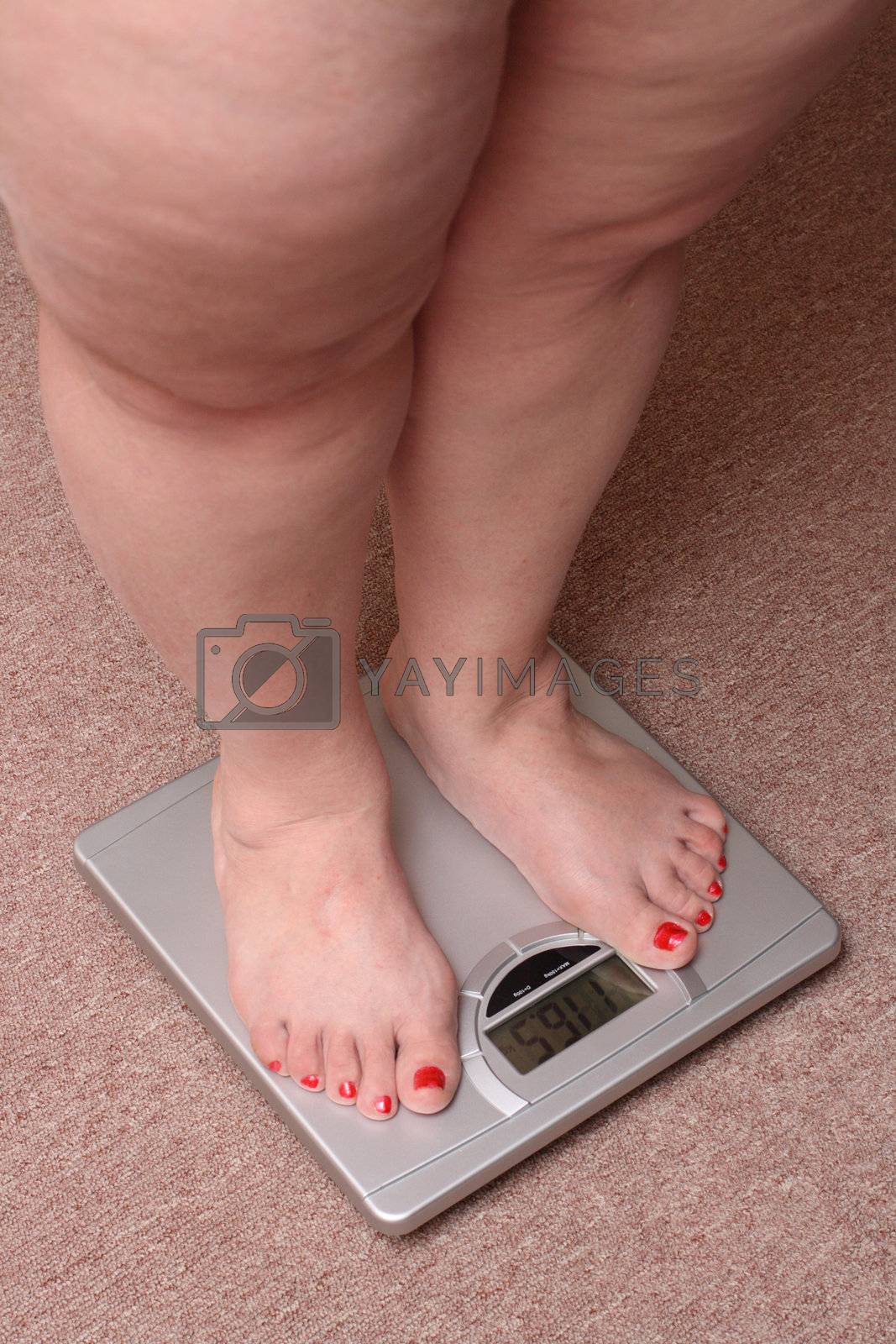 Royalty free image of women legs with overweight by Mikko