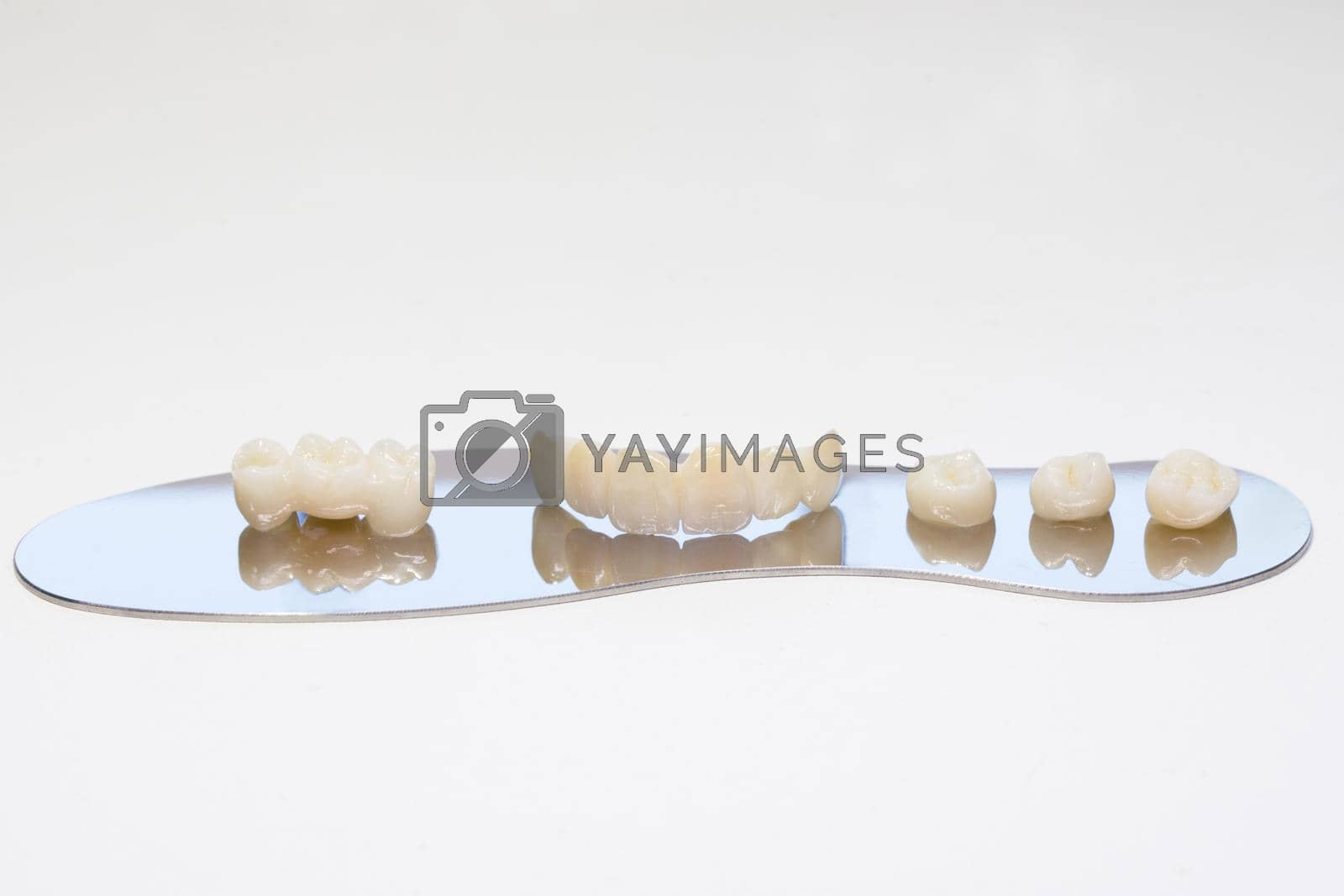 Royalty free image of Zirconium tooth crown. Isolate on background. Aesthetic restoration of tooth loss. Ceramic zirconium in final version. Metal Free Ceramic Dental Crowns. by uflypro
