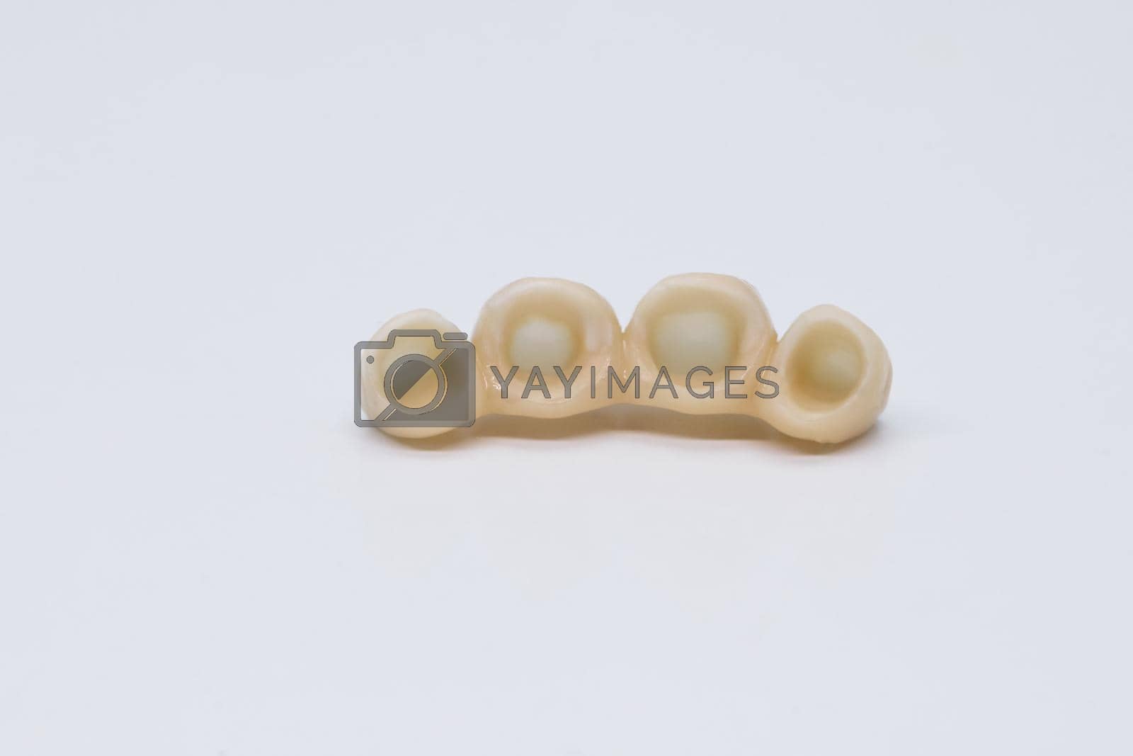 Metal free ceramic dental crowns. Dental ceramic bridge on isolated wite background.