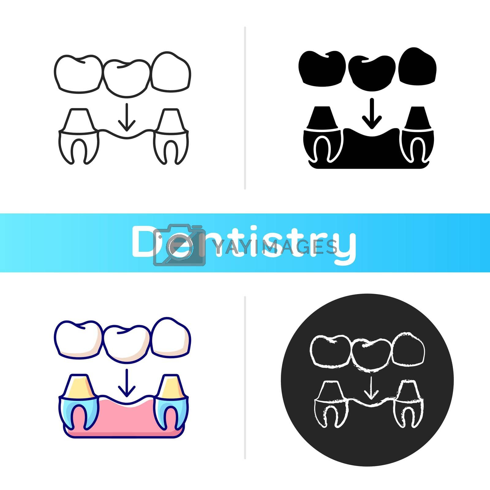 Dental prosthetics icon. Implant design. Instruments for dental treatment. Contemporary dental treatment. Linear black and RGB color styles. Isolated vector illustrations