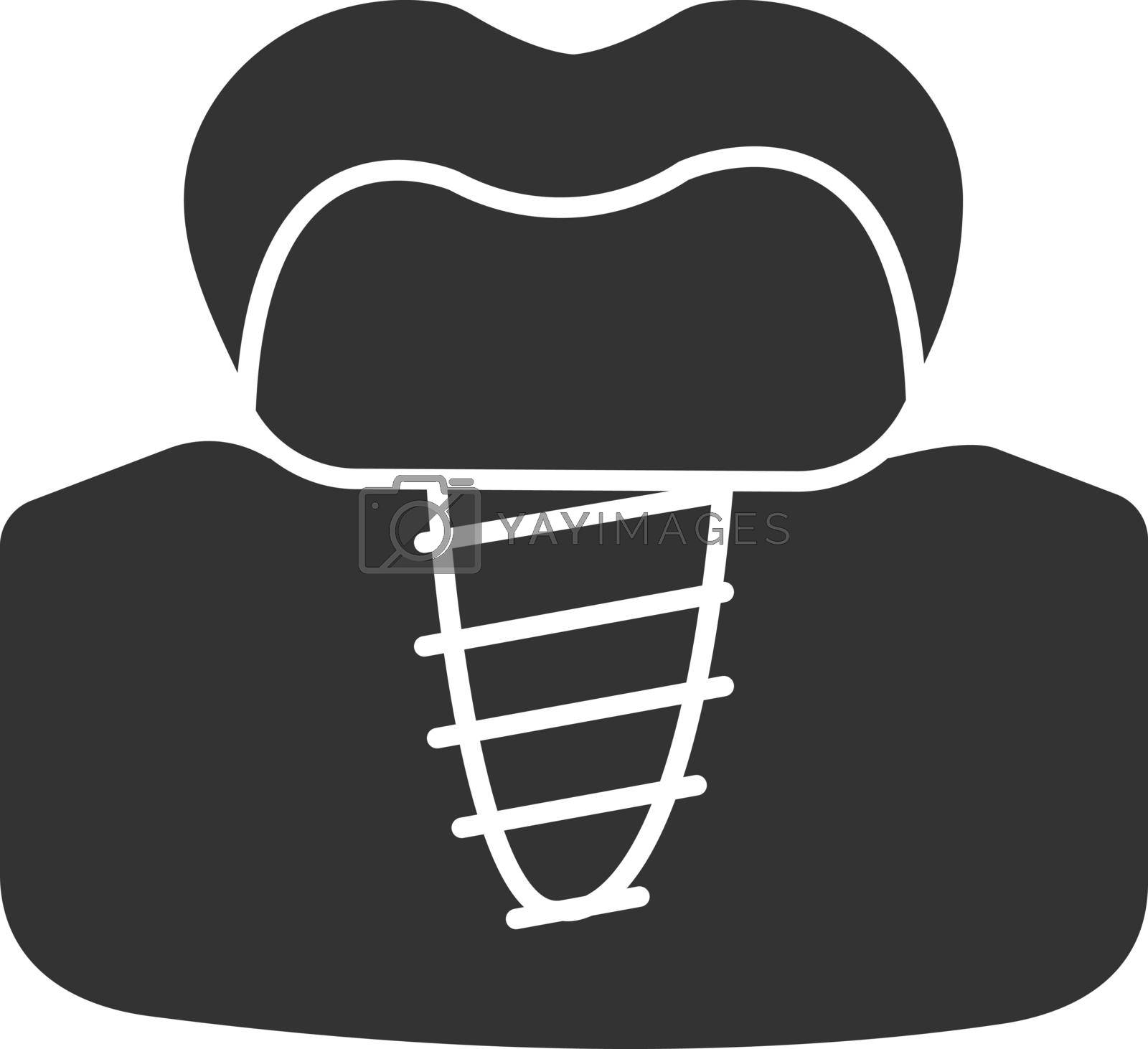 Dental implant glyph icon. Endosseous implant. Silhouette symbol. Negative space. Vector isolated illustration
