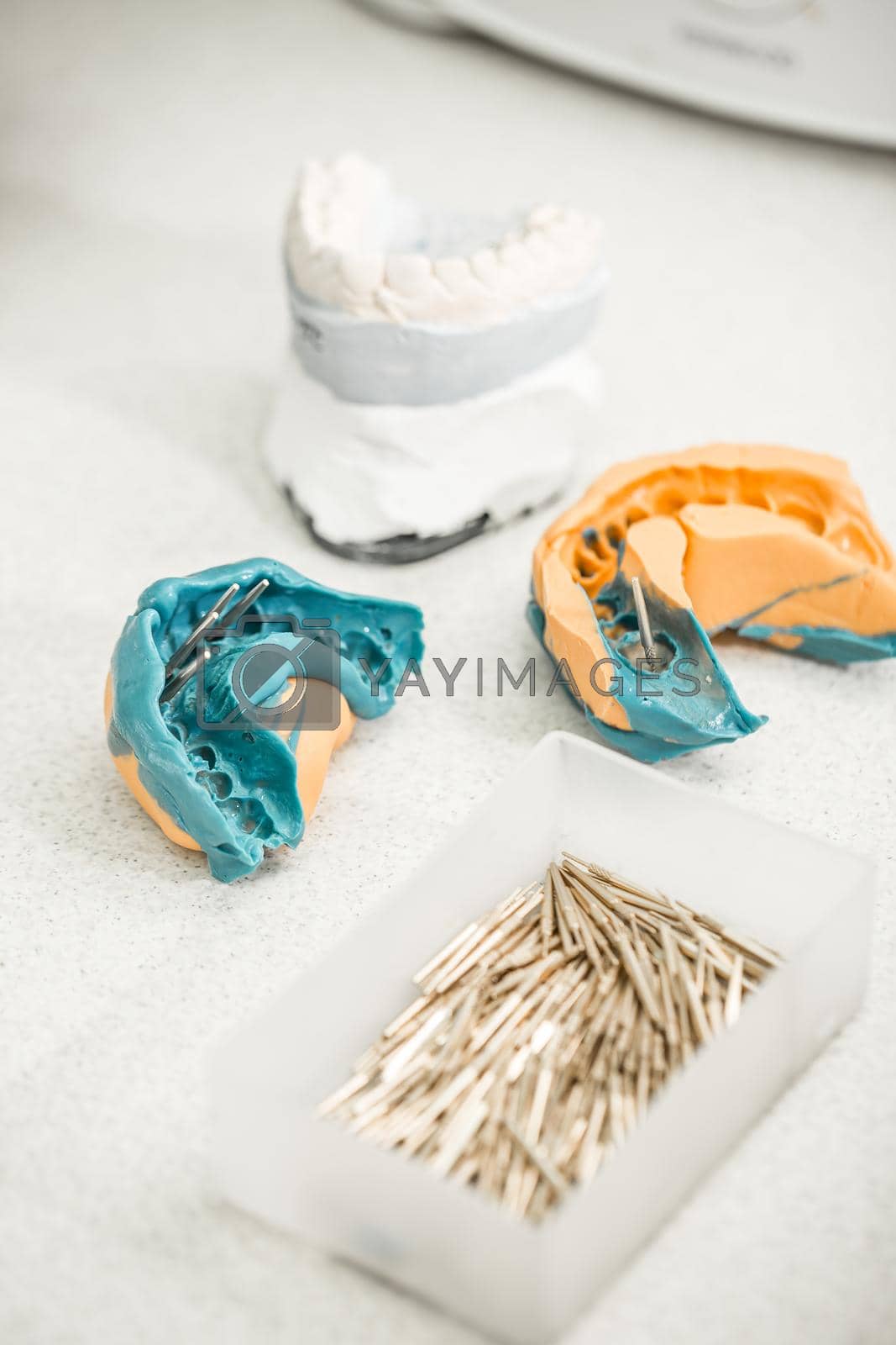 Dental impression and tooth model, denture concept