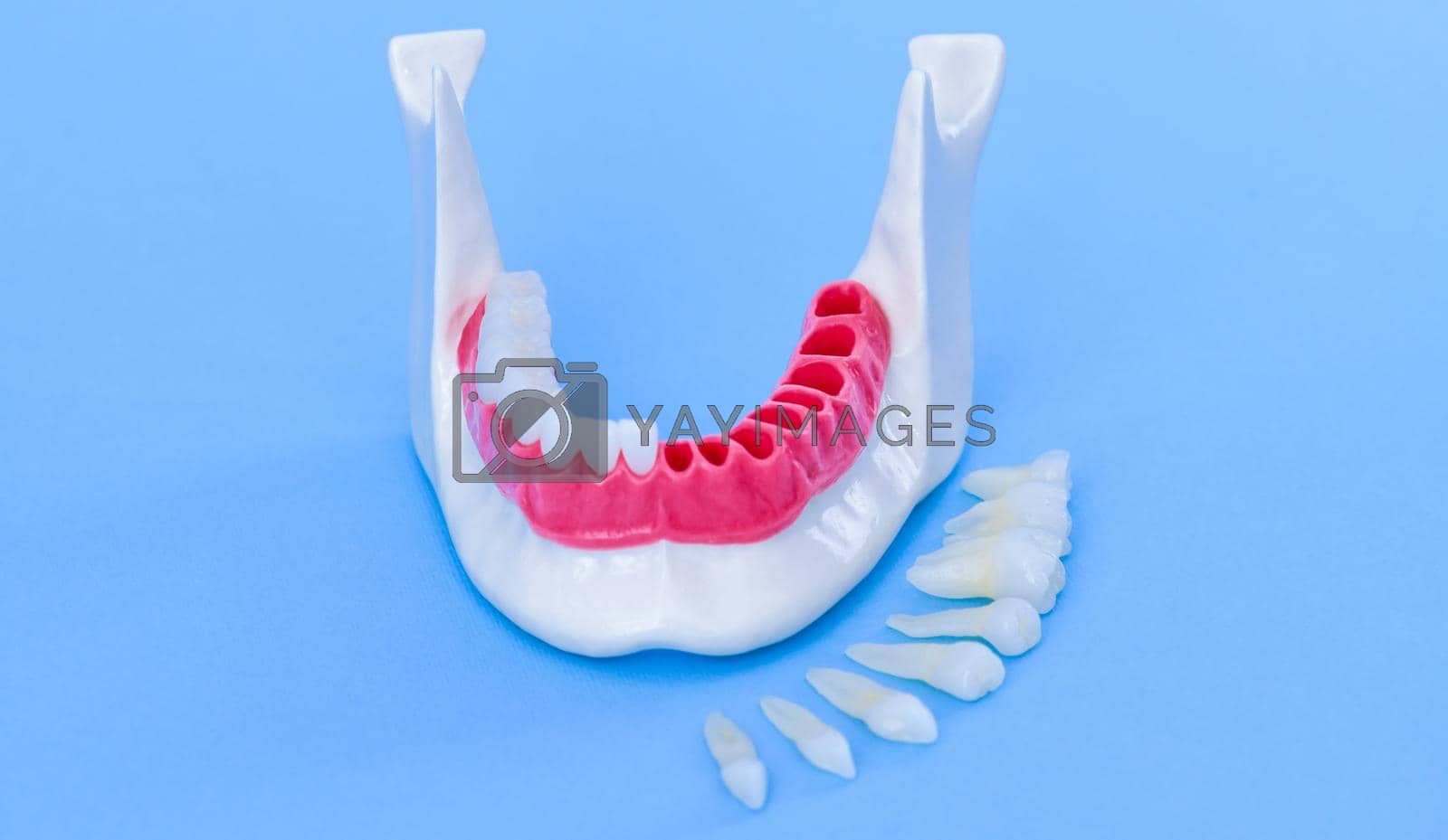 Royalty free image of Tooth implant and crown installation process by dotshock