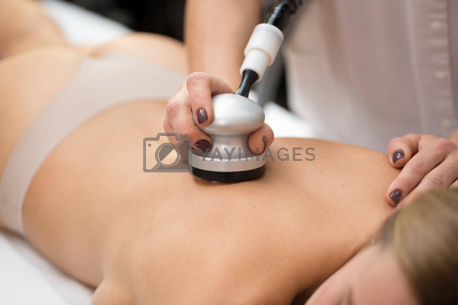 Royalty free image of Vacuum roller massage. Hardware correction of the figure with the help of equipment equipped with a vacuum-roller manipulator. Massage of the back. by StudioPeace