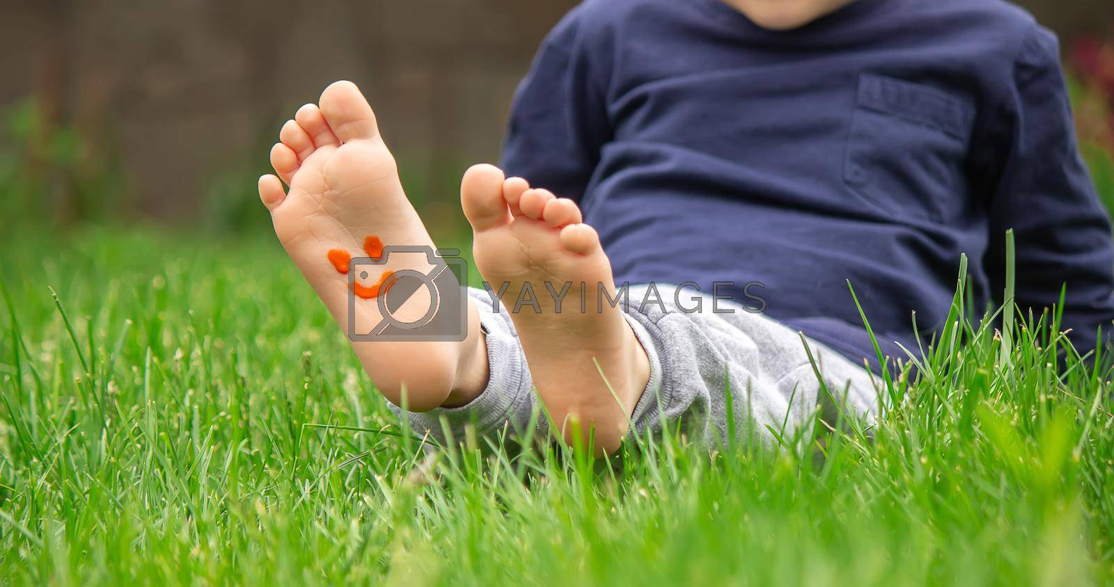 Royalty free image of child sitting on the grass, smiling on the child's leg with paints, selective focus by Anuta23