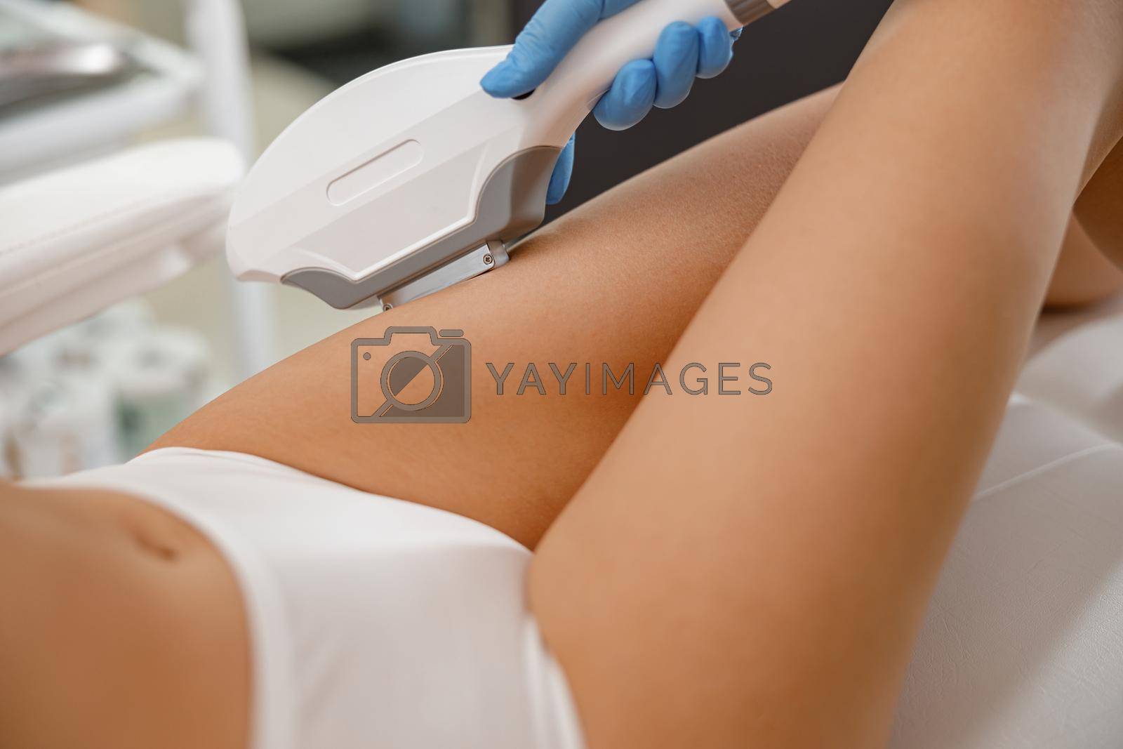 Woman with smooth skin getting legs epilation with ipl machine in beauty salon. Hair removal